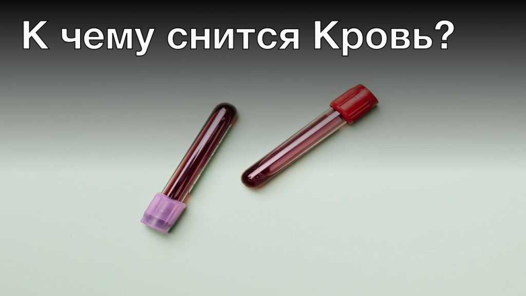К Чему Снится Кровь: Толкование, Символизм и Значение в Сновидениях